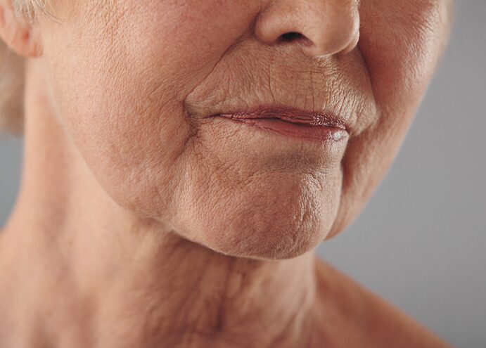 Aging Skin Aging Skin