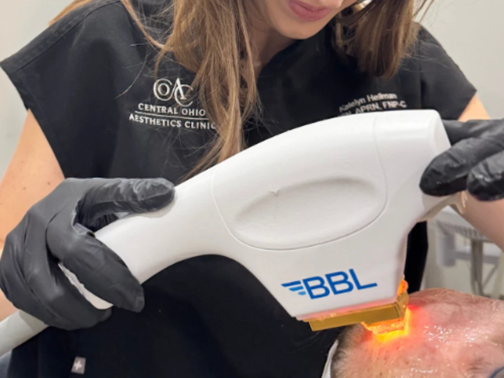 A woman in a black uniform performs a skin treatment using a BBL device on a patient's forehead. She wears black gloves, conveying a clinical setting.
