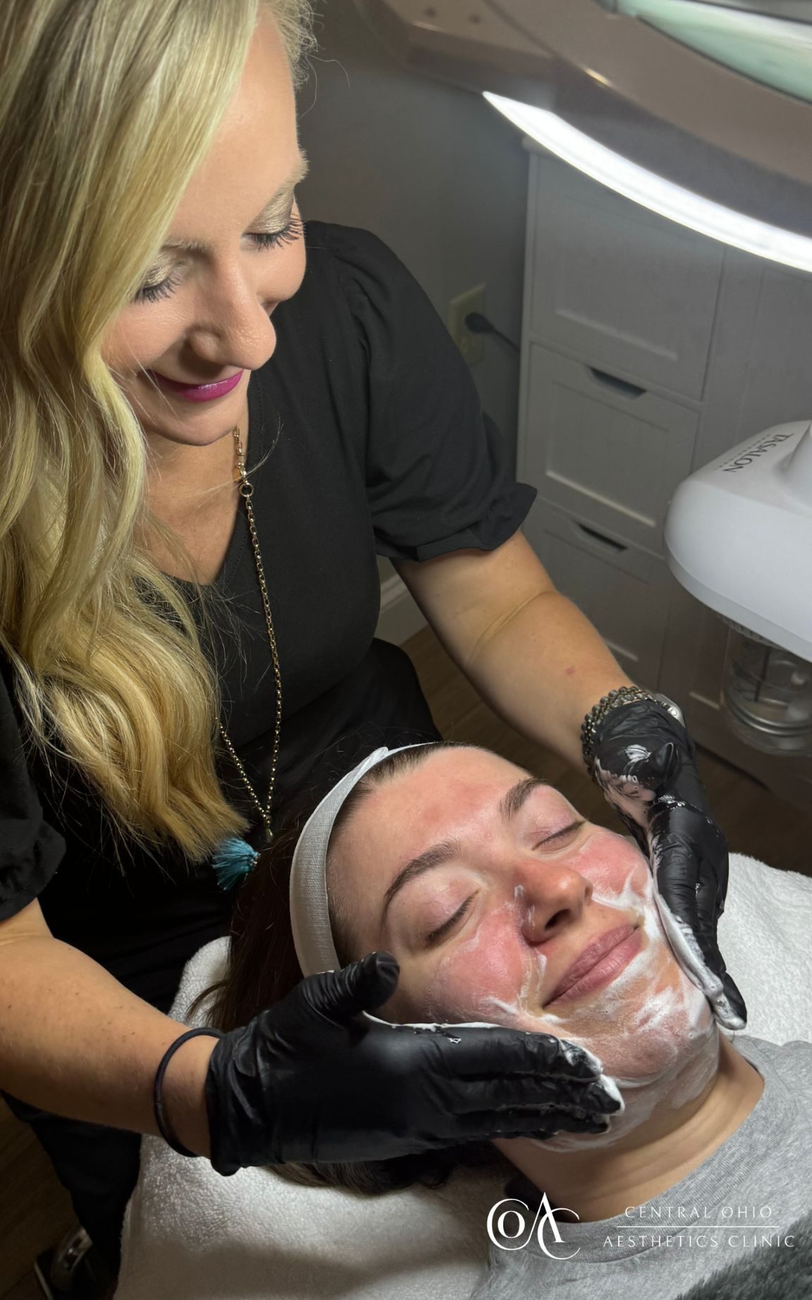 PRP Treatment