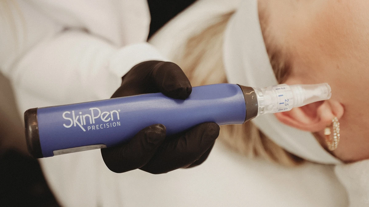 How Microneedling Improves Skin Texture and Tone