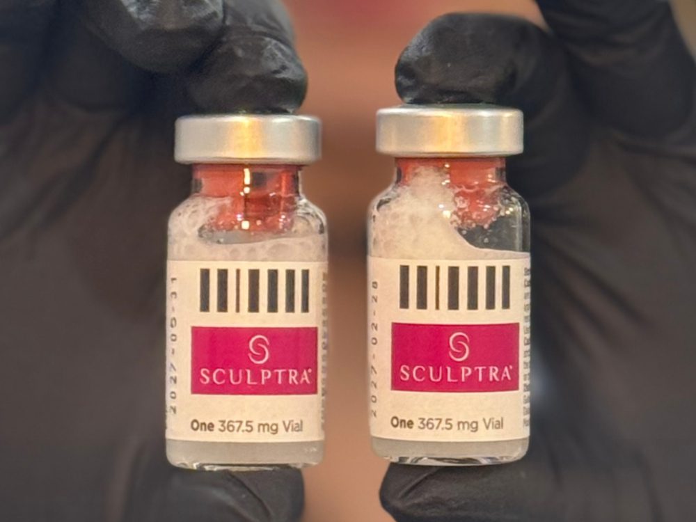 Two small vials labeled "Sculptra" are held by gloved hands. The vials have a red label with black and white design, conveying a clinical setting.