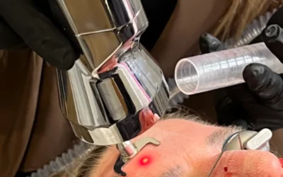 How Skin Resurfacing Treatments Work to Refresh and Renew Your Skin