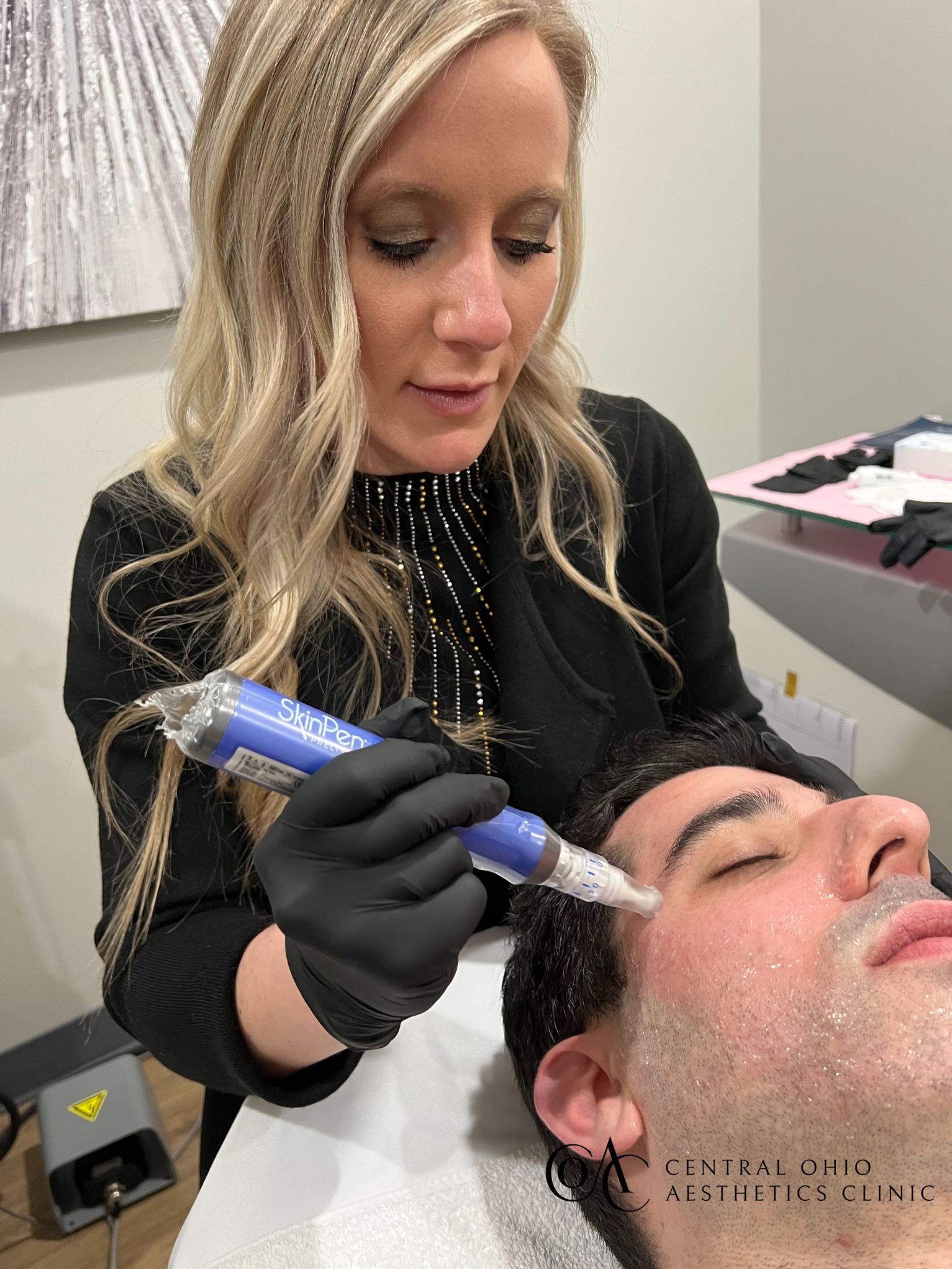 Microneedling Treatment Microneedling Treatment