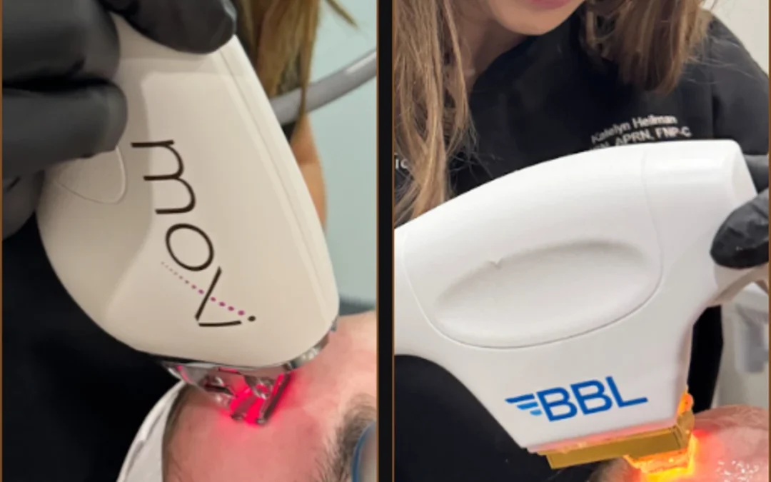 Moxi™ vs BBL®: Which Laser Treatment is Right for You?