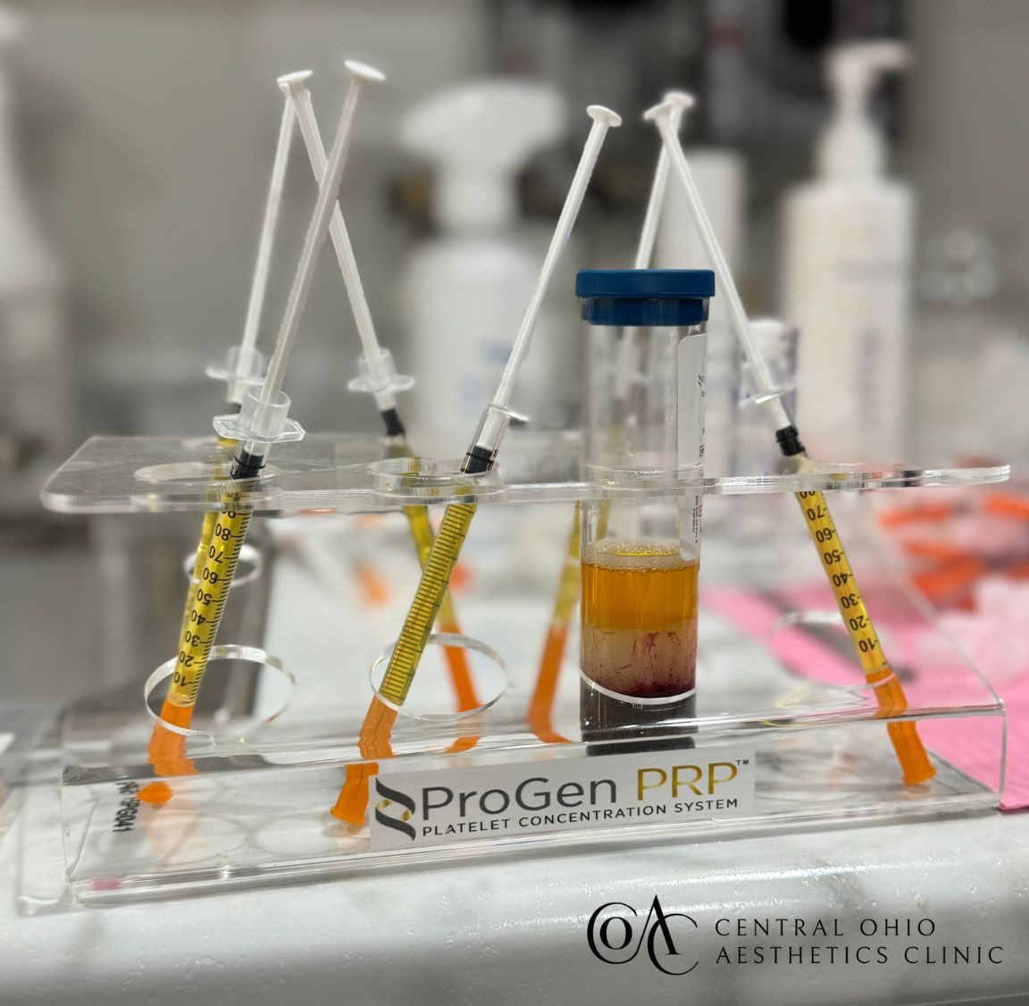 PRP Treatment PRP Treatment