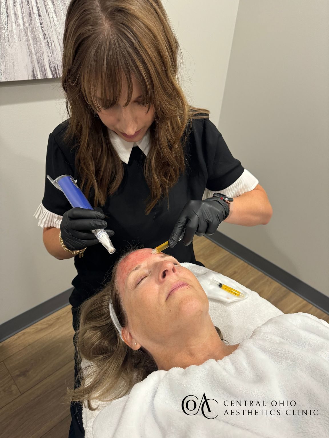PRP Treatment PRP Treatment