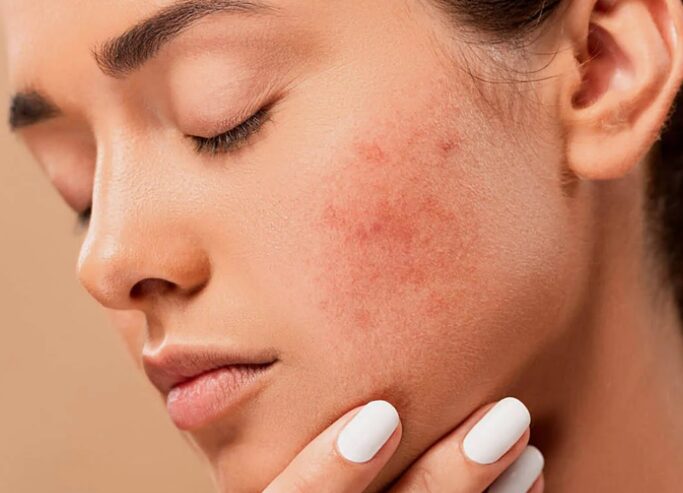 Sensitive Skin Sensitive Skin