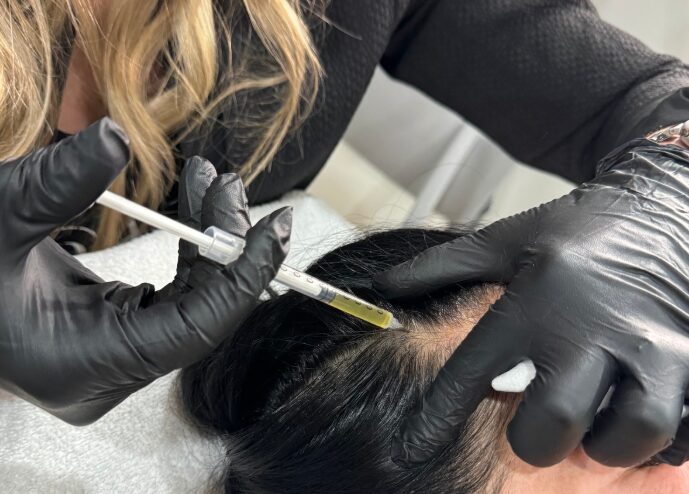 Thinning Hair Thinning Hair