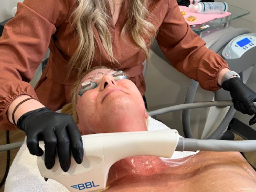 A woman receives a beauty treatment using a BBL device in a clinic. She wears protective goggles. The technician is holding the device, wearing black gloves.