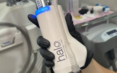 Your Guide to Laser Treatment for Sun Damage