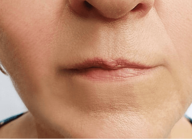 A woman with a small lip and a petite nose, showcasing her unique facial features.