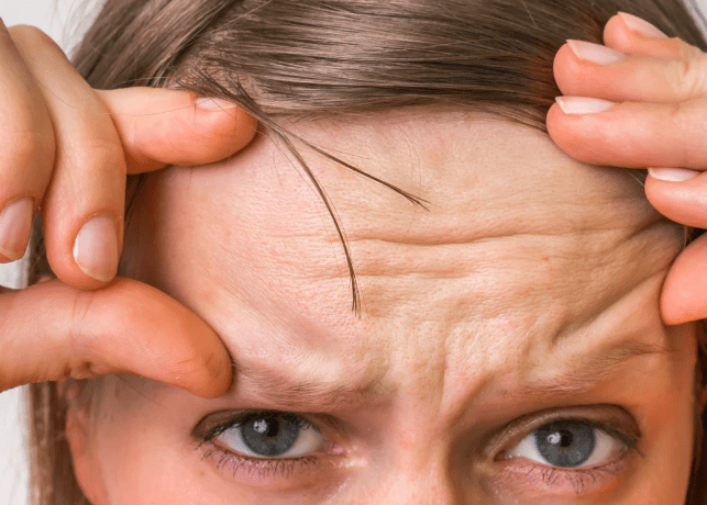 A woman with her hands on her forehead, appearing thoughtful or stressed.