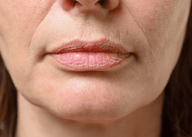 A woman with a very thin face and delicate lips, gazing thoughtfully into the distance.
