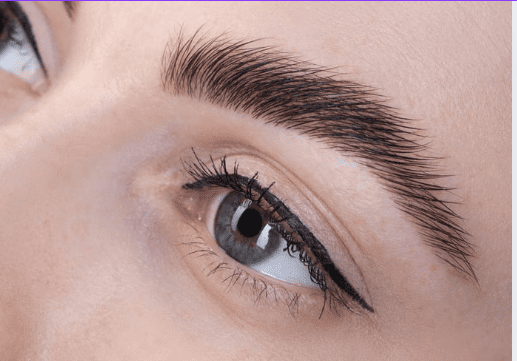 Brow lift Brow lift