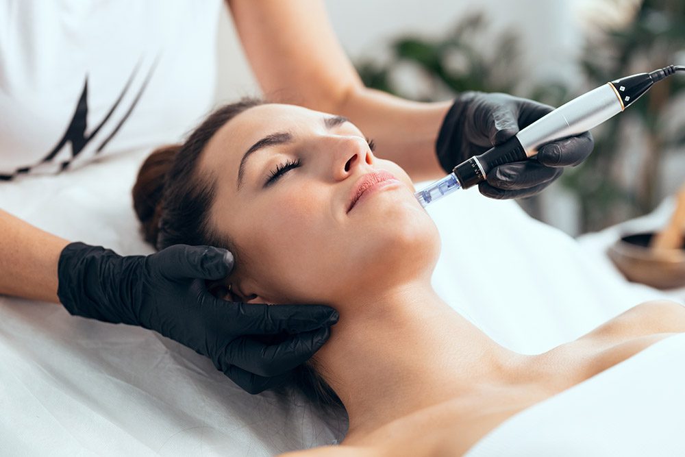 Microneedling Columbus